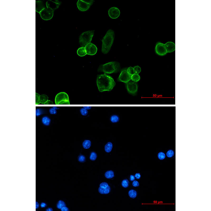 Anti-EpCAM Rabbit Monoclonal Antibody
