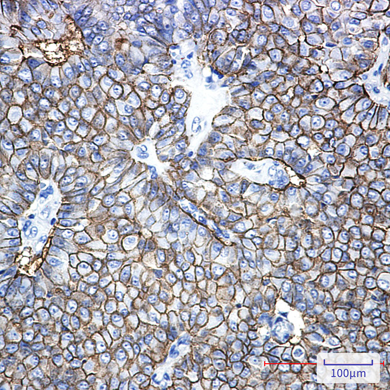 Anti-EpCAM Rabbit Monoclonal Antibody