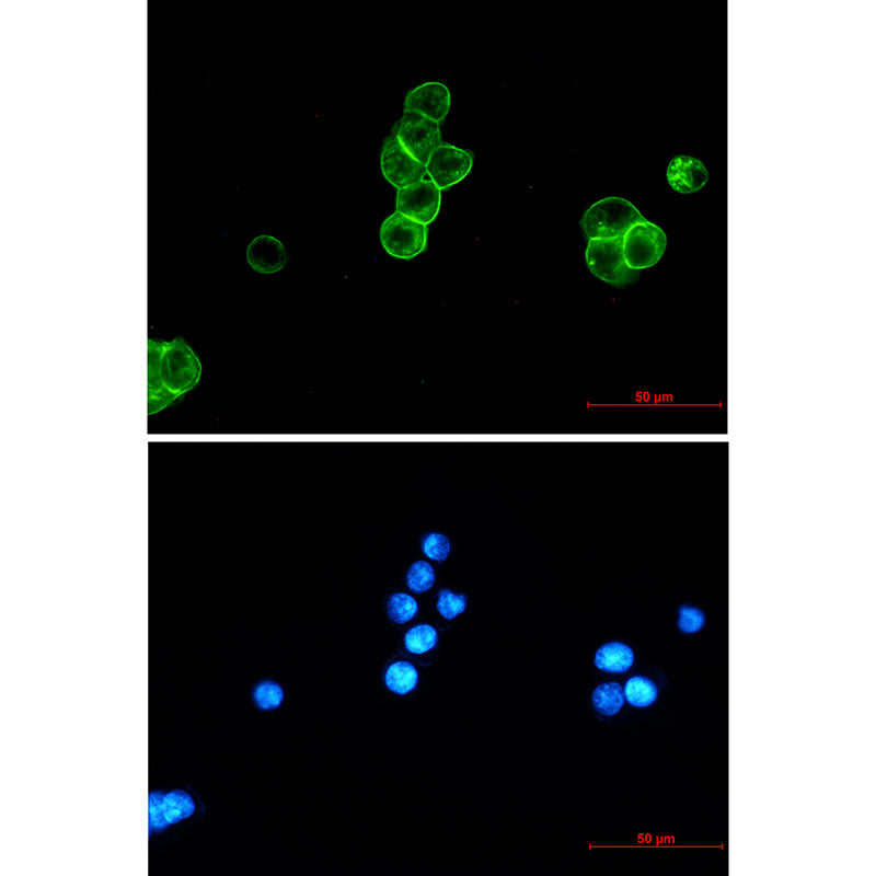 Anti-EpCAM Rabbit Monoclonal Antibody