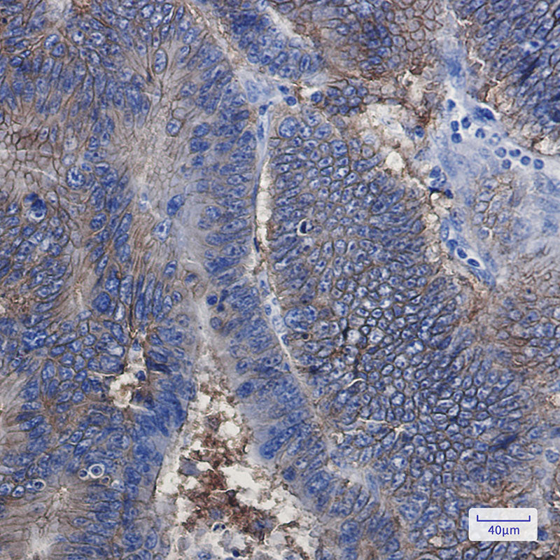 Anti-EpCAM Rabbit Monoclonal Antibody