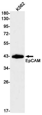 Anti-EpCAM Rabbit Monoclonal Antibody