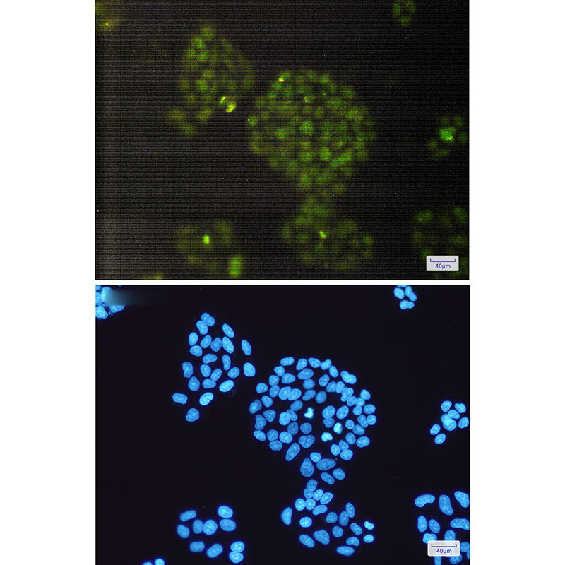 Anti-ERCC1 Rabbit Monoclonal Antibody