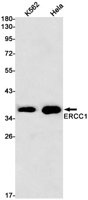 Anti-ERCC1 Rabbit Monoclonal Antibody