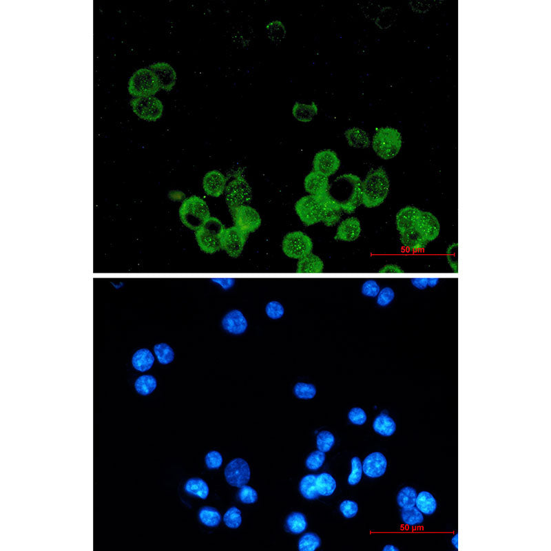 Anti-Estrogen Receptor alpha Rabbit Monoclonal Antibody