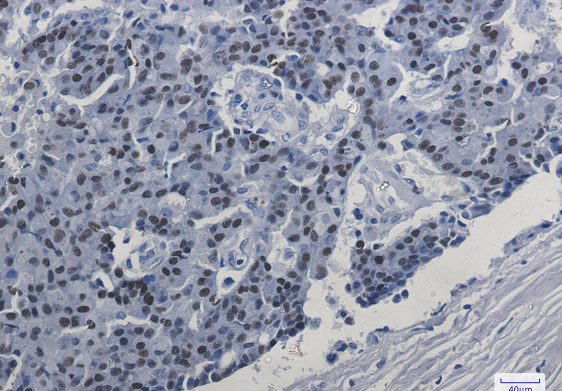 Anti-Estrogen Receptor alpha Rabbit Monoclonal Antibody