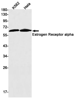 Anti-Estrogen Receptor alpha Rabbit Monoclonal Antibody
