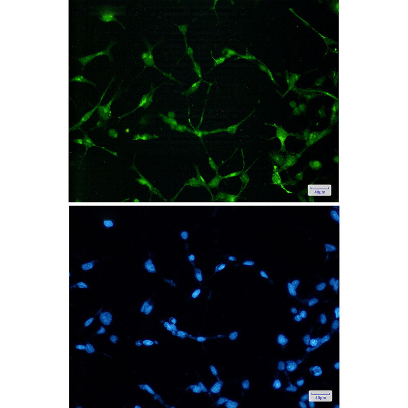 Anti-EWSR1 Rabbit Monoclonal Antibody