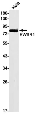 Anti-EWSR1 Rabbit Monoclonal Antibody
