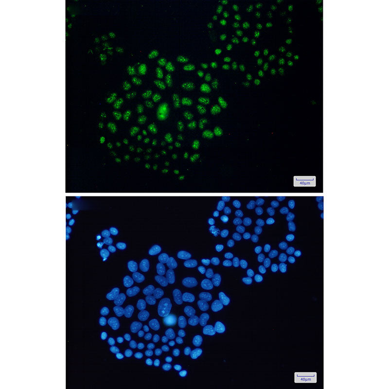 Anti-EWSR1 Rabbit Monoclonal Antibody