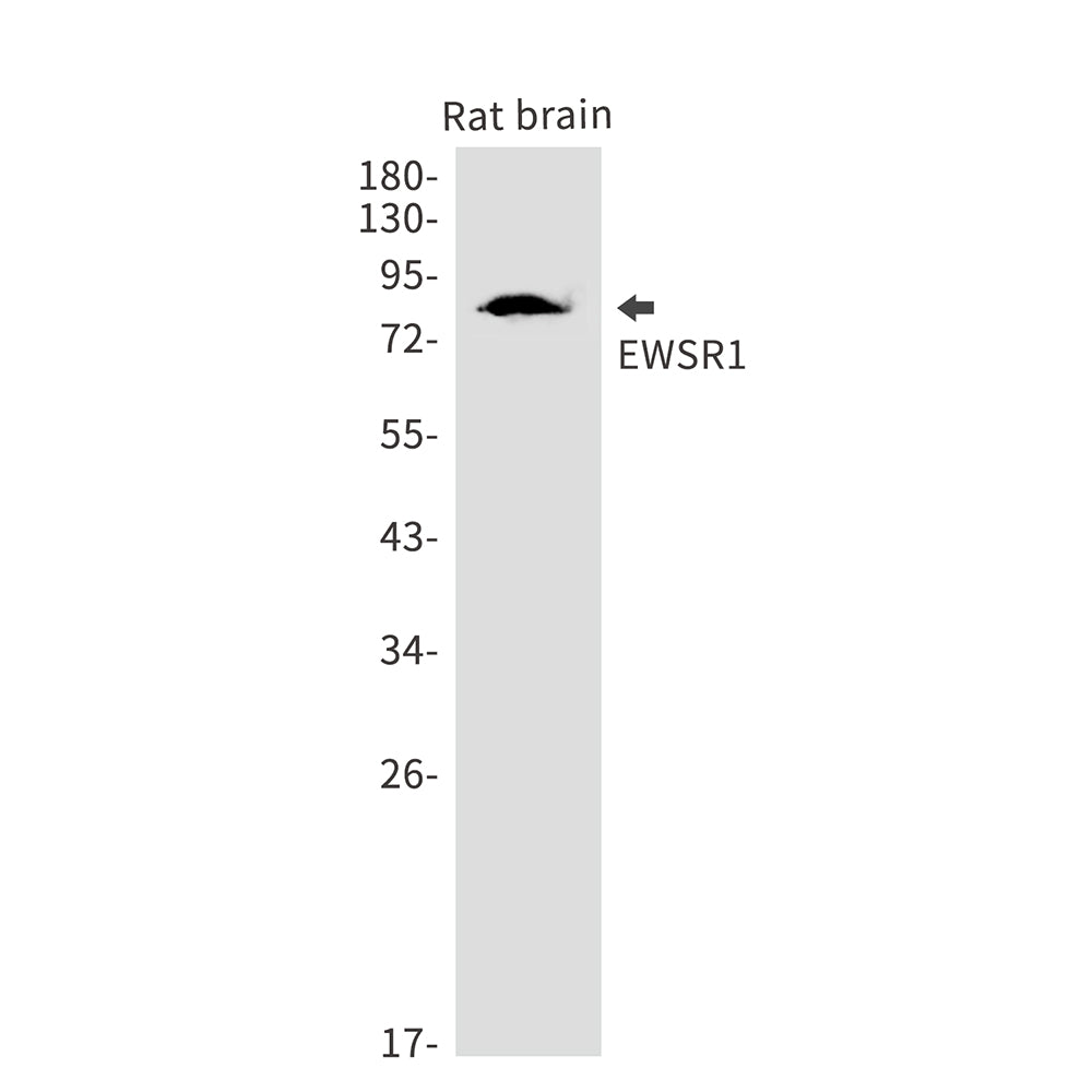Anti-EWSR1 Rabbit Monoclonal Antibody