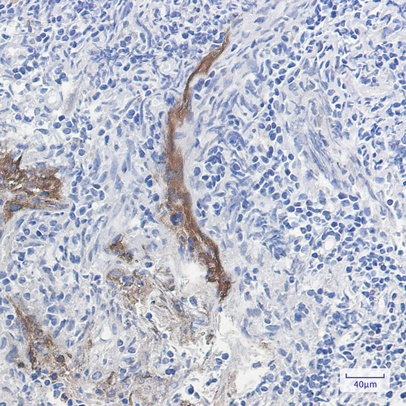 Anti-Extracellular Matrix Protein 1 Rabbit Monoclonal Antibody