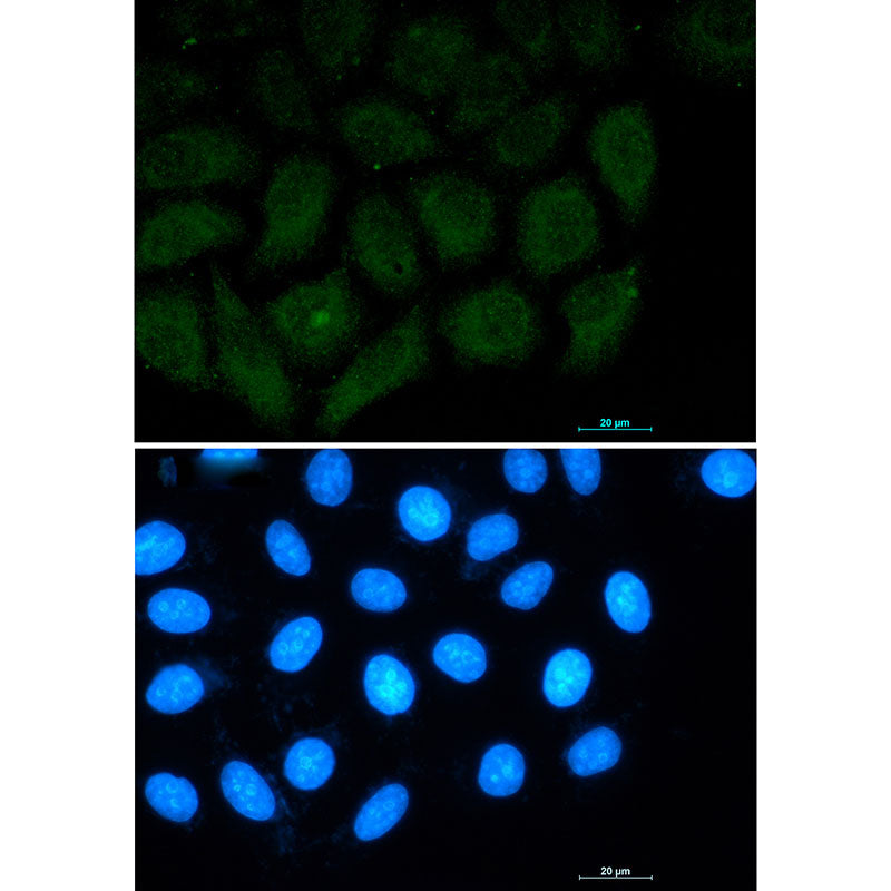 Anti-FAK Rabbit Monoclonal Antibody