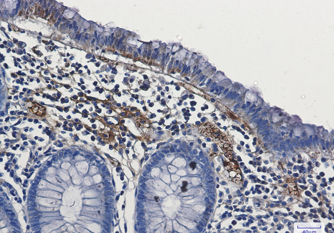Anti-FAK Rabbit Monoclonal Antibody