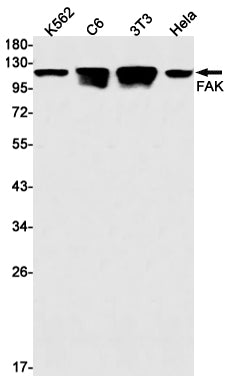 Anti-FAK Rabbit Monoclonal Antibody