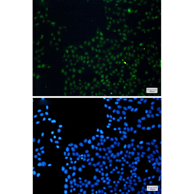 Anti-FAM98B Rabbit Monoclonal Antibody