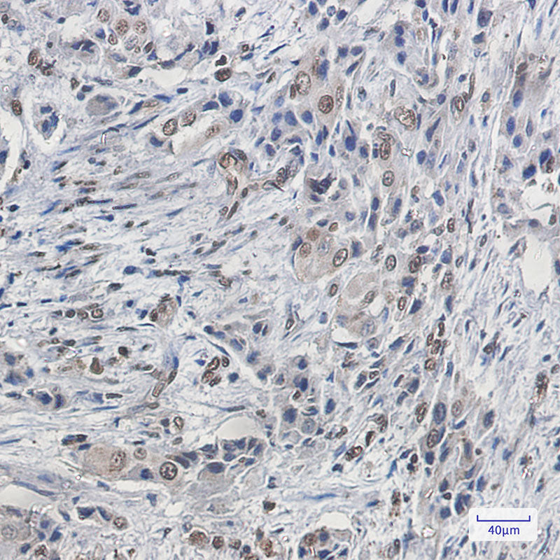 Anti-FBP1 Rabbit Monoclonal Antibody