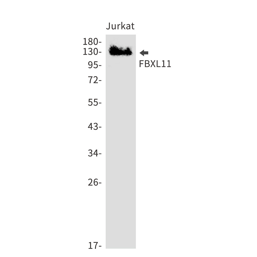 Anti-KDM2A Rabbit Monoclonal Antibody