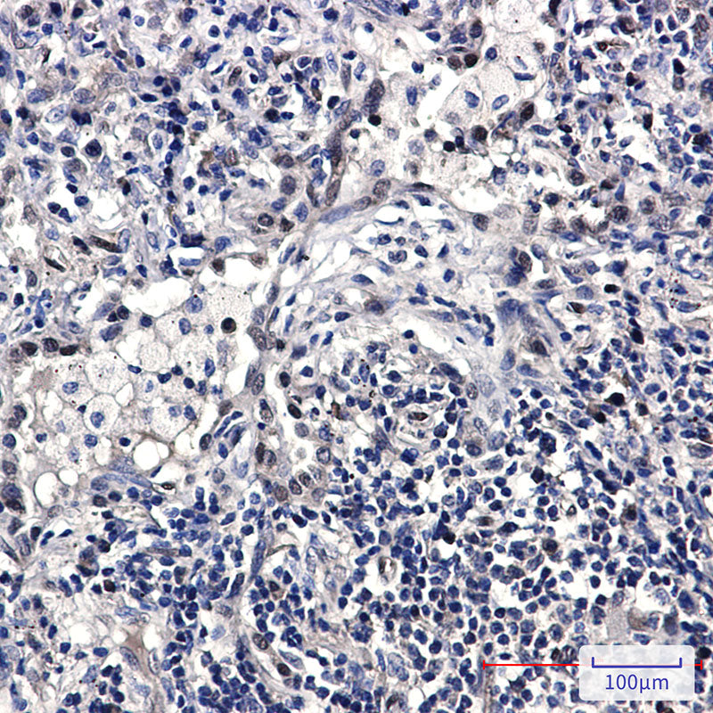 Anti-FDPS Rabbit Monoclonal Antibody