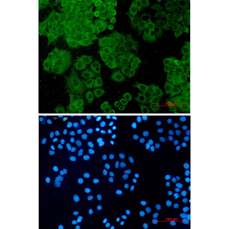 Anti-FH Rabbit Monoclonal Antibody