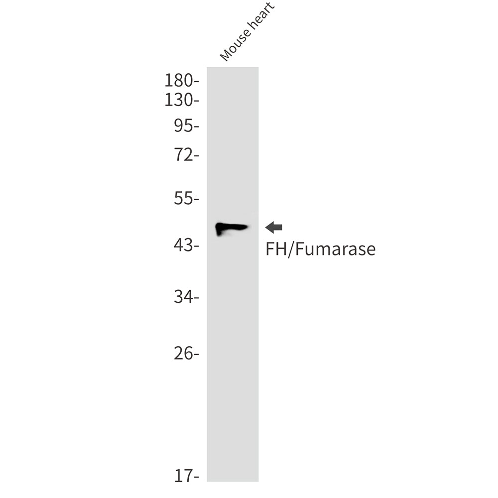 Anti-FH Rabbit Monoclonal Antibody