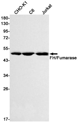 Anti-FH Rabbit Monoclonal Antibody