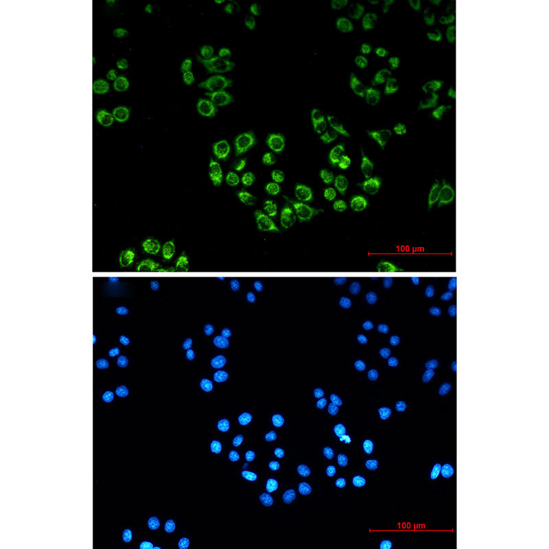 Anti-FH Rabbit Monoclonal Antibody