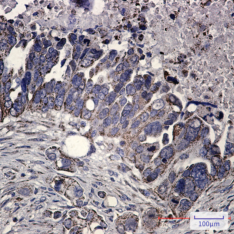Anti-FH Rabbit Monoclonal Antibody