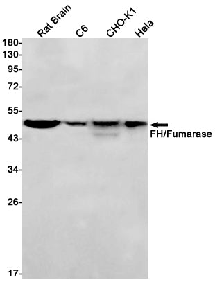 Anti-FH Rabbit Monoclonal Antibody