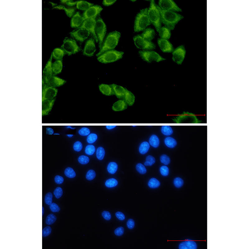 Anti-FH Rabbit Monoclonal Antibody