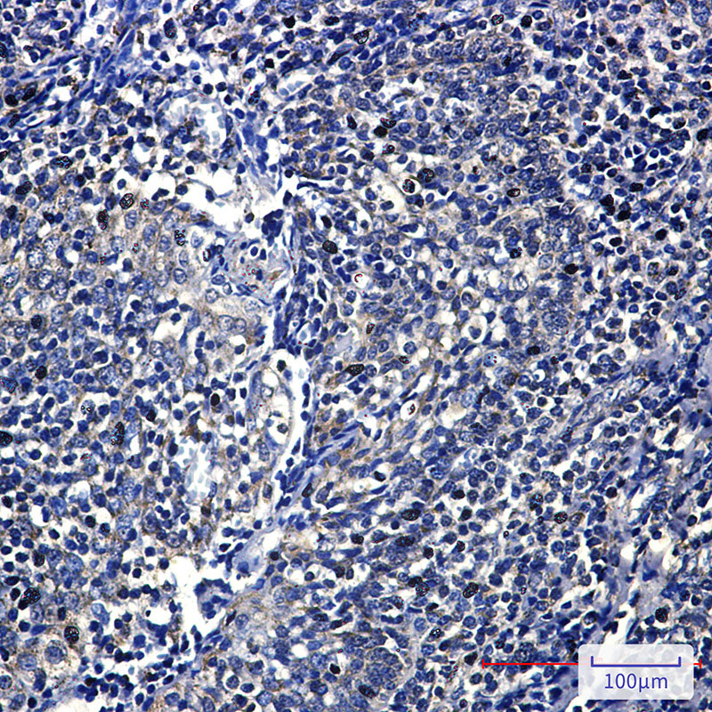 Anti-FH Rabbit Monoclonal Antibody