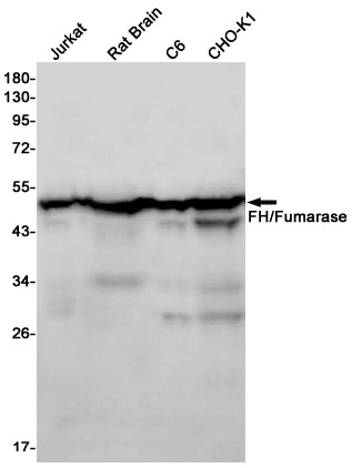 Anti-FH Rabbit Monoclonal Antibody