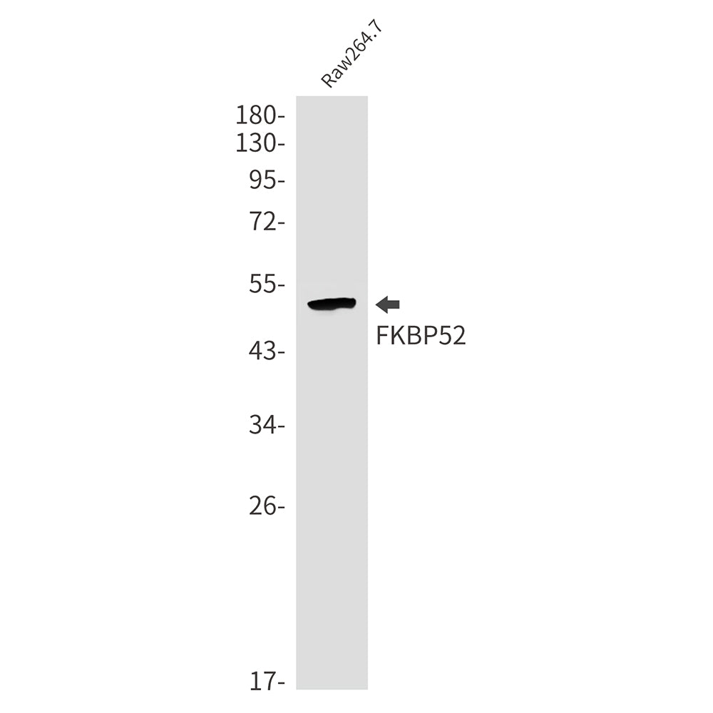 Anti-FKBP52 Rabbit Monoclonal Antibody