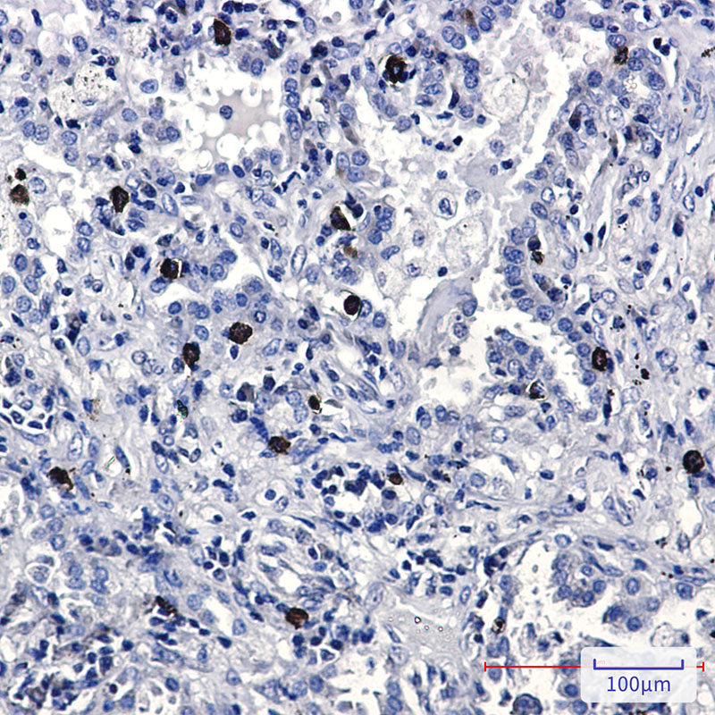 Anti-FLI1 Rabbit Monoclonal Antibody