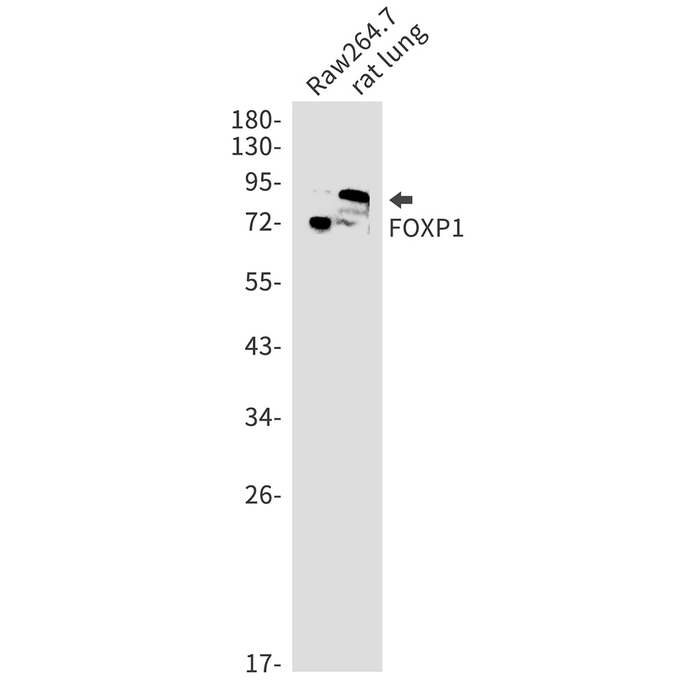 Anti-FOXP1 Rabbit Monoclonal Antibody