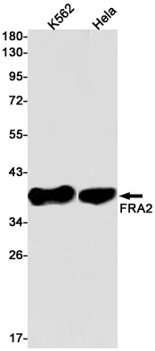 Anti-FRA2 Rabbit Monoclonal Antibody