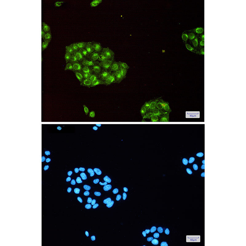 Anti-Fragilis Rabbit Monoclonal Antibody