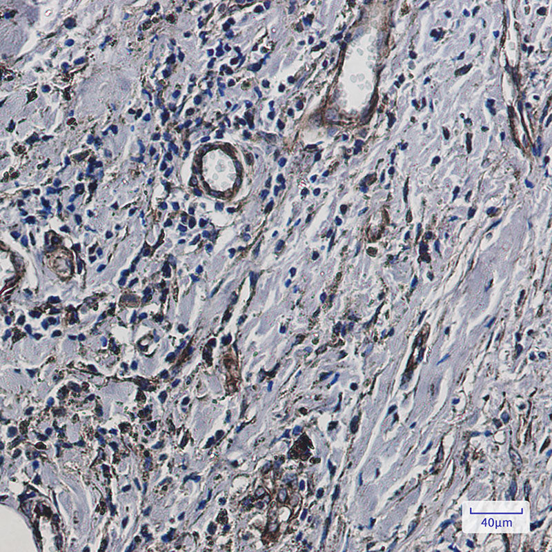 Anti-Fragilis Rabbit Monoclonal Antibody