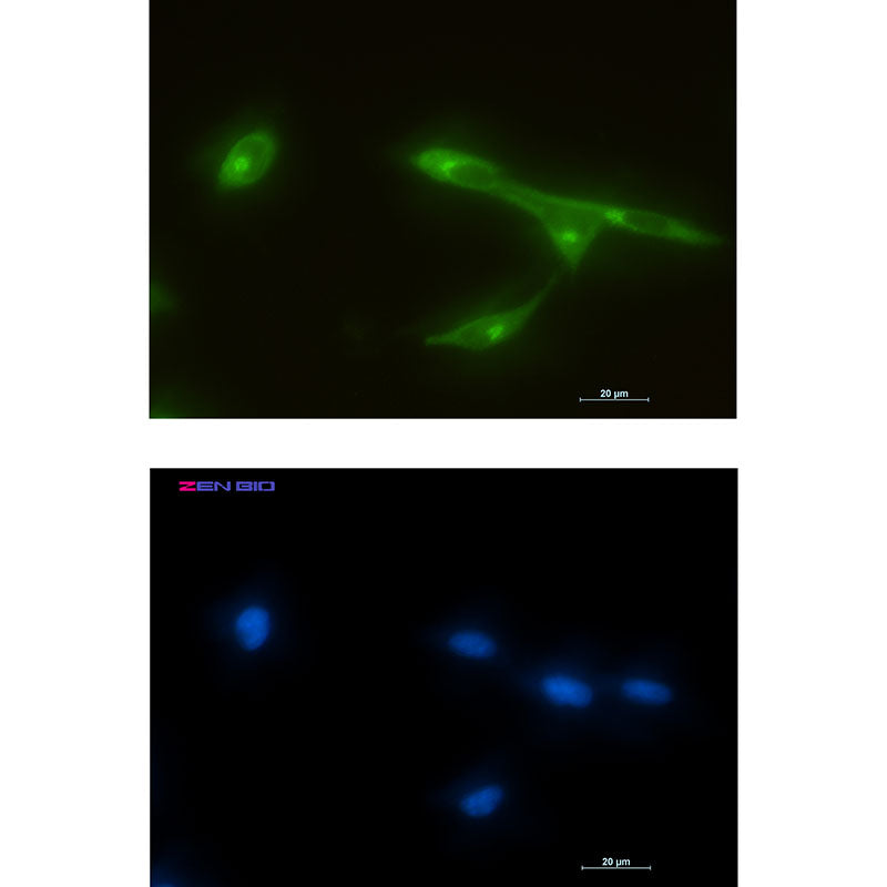 Anti-FRAT1 Rabbit Monoclonal Antibody