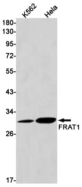 Anti-FRAT1 Rabbit Monoclonal Antibody