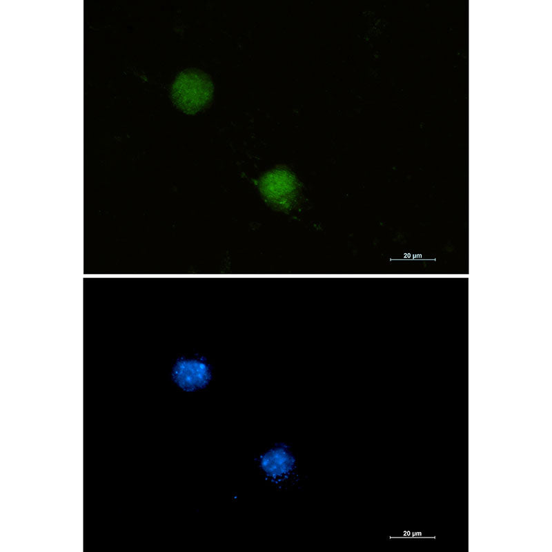 Anti-FUBP1 Rabbit Monoclonal Antibody