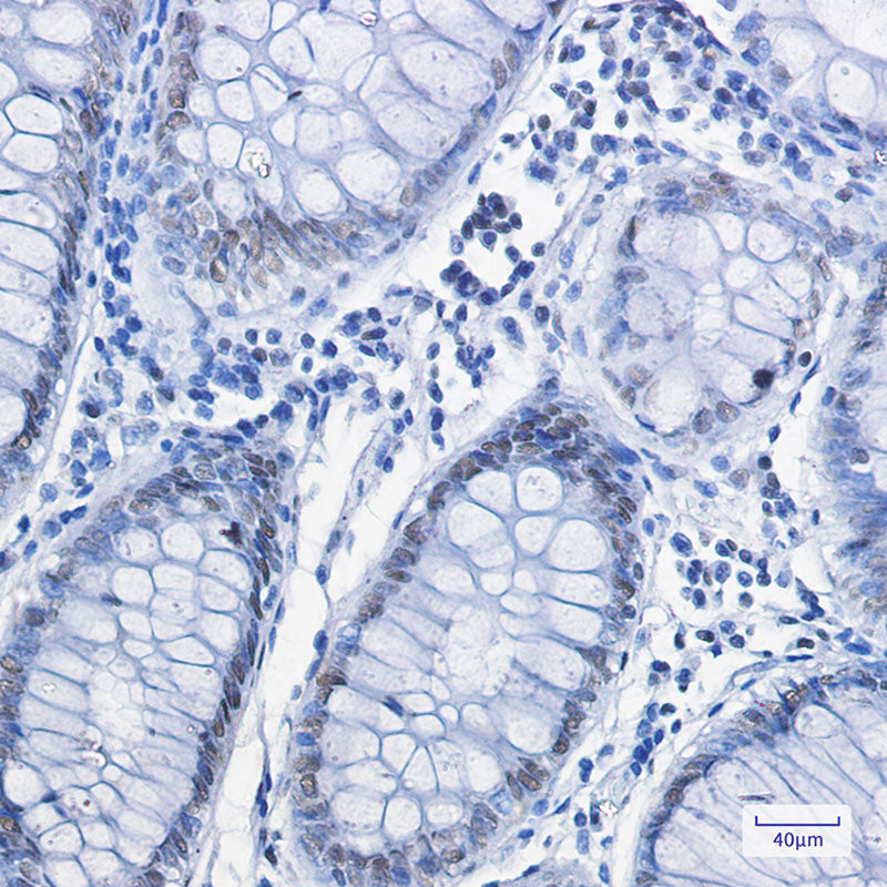 Anti-FUBP1 Rabbit Monoclonal Antibody