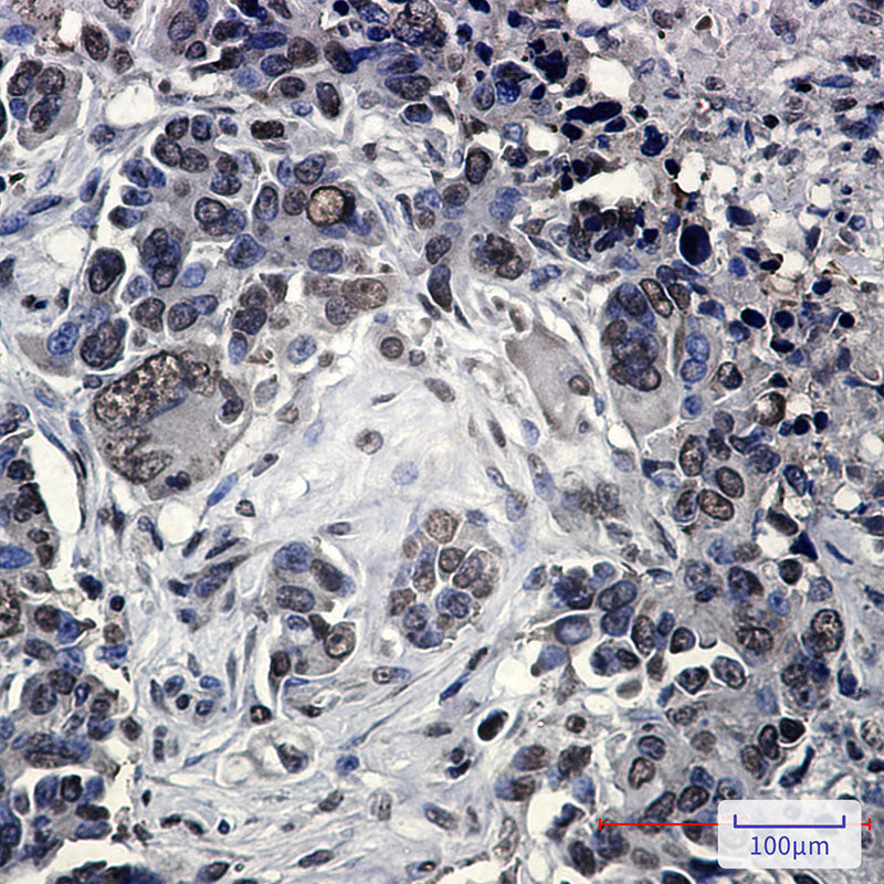 Anti-FUBP1 Rabbit Monoclonal Antibody