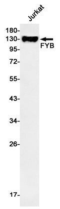 Anti-FYB Rabbit Monoclonal Antibody