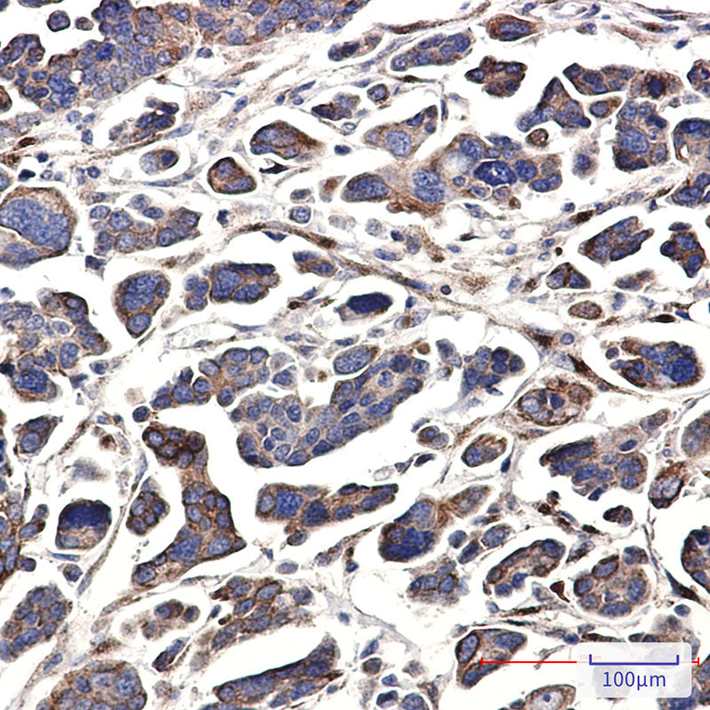 Anti-GNA13 Rabbit Monoclonal Antibody