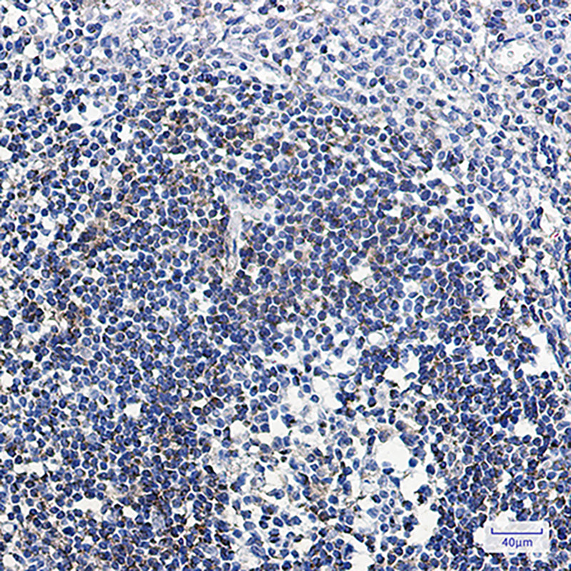 Anti-ABAT Rabbit Monoclonal Antibody