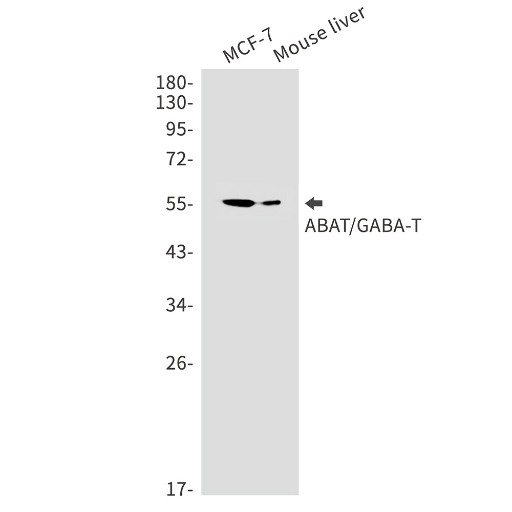 Anti-ABAT Rabbit Monoclonal Antibody