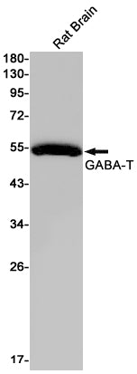 Anti-ABAT Rabbit Monoclonal Antibody