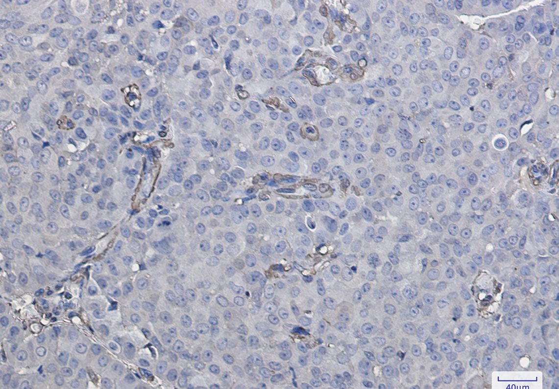 Anti-Galectin 1 Rabbit Monoclonal Antibody