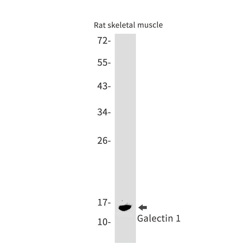 Anti-Galectin 1 Rabbit Monoclonal Antibody