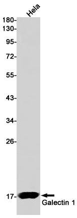 Anti-Galectin 1 Rabbit Monoclonal Antibody